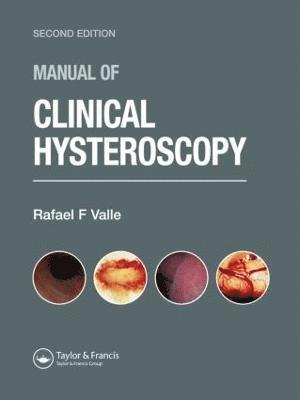 Rafael F. Valle - Manual of Clinical Hysteroscopy, Second Edition, Inbunden