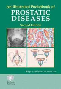 bokomslag An Illustrated Pocketbook of Prostatic Disease