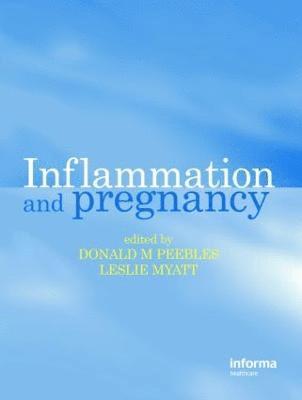 bokomslag Inflammation and Pregnancy