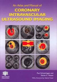 bokomslag An Atlas and Manual of Coronary Intravascular Ultrasound Imaging