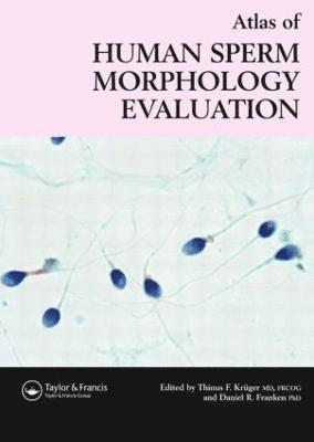 Atlas of Human Sperm Morphology Evaluation 1