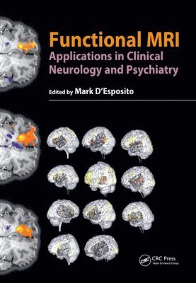 bokomslag Functional MRI