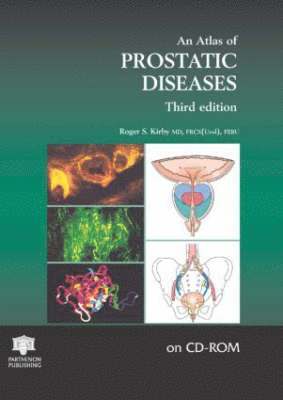 bokomslag Atlas Of Prostatic Disease