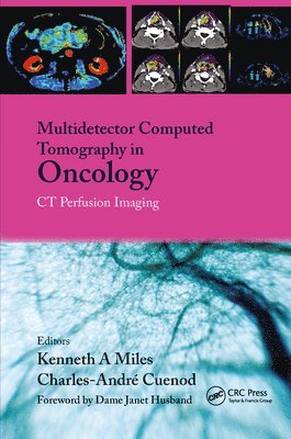 bokomslag Multi-Detector Computed Tomography in Oncology