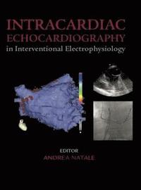 bokomslag Intracardiac Echocardiography in Interventional Electrophysiology