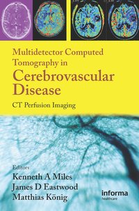 bokomslag Multidetector Computed Tomography in Cerebrovascular Disease