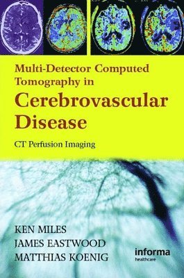 Kenneth Miles, James D. Eastwood, Matthias Konig - Multidetector Computed Tomography in Cerebrovascular Disease, Inbunden