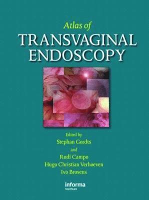 Atlas of Transvaginal Endoscopy 1