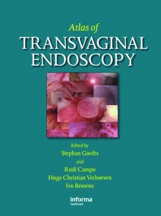 Atlas of Transvaginal Endoscopy 1