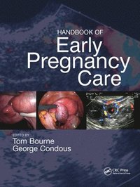 bokomslag Handbook of Early Pregnancy Care