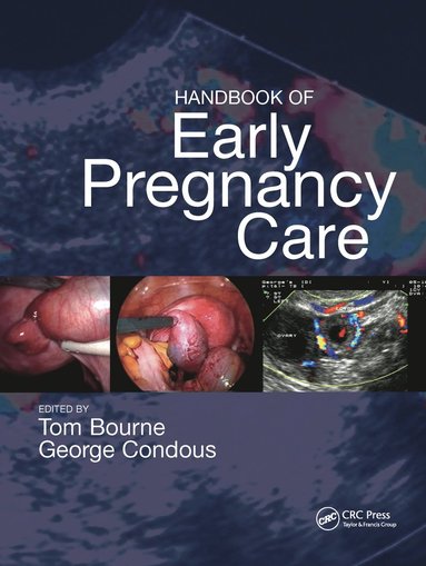 bokomslag Handbook of Early Pregnancy Care