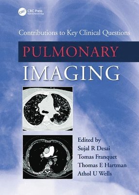 Pulmonary Imaging 1