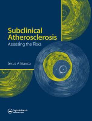 bokomslag Subclinical Atherosclerosis