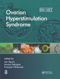bokomslag Ovarian Hyperstimulation Syndrome