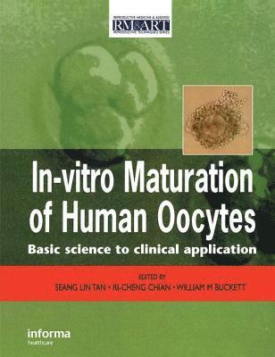 In Vitro Maturation of Human Oocytes 1