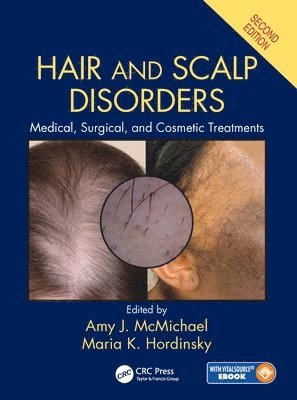 Hair and Scalp Disorders 1