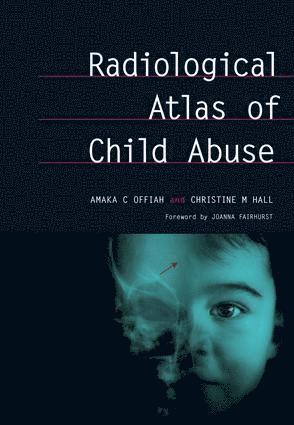 Amaka Offiah, Christine Hall - Radiological Atlas of Child Abuse, Inbunden