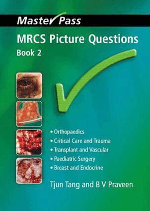 Tjun Tang, BV Praveen - MRCS Picture Questions, Häftad