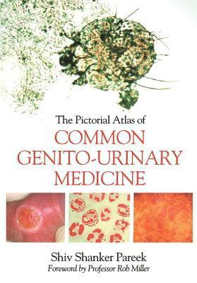 The Pictorial Atlas of Common Genito-Urinary Medicine 1