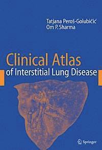 Clinical Atlas of Interstitial Lung Disease