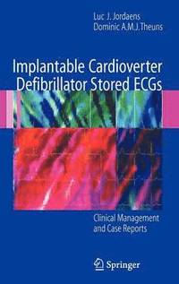 bokomslag Implantable Cardioverter Defibrillator Stored ECGs