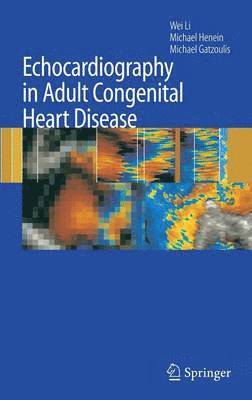 Wei Li, Michael Henein, Michael A. Gatzoulis, Wei Li, Michael Henein - Echocardiography in Adult Congenital Heart Disease, Inbunden