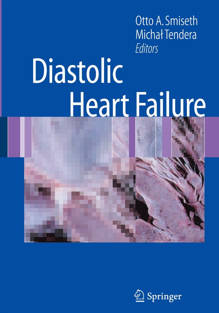 Otto A. Smiseth, Michal Tendera - Diastolic Heart Failure, Inbunden