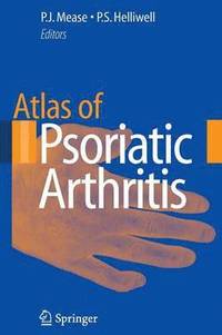 bokomslag Atlas of Psoriatic Arthritis