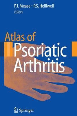 Atlas of Psoriatic Arthritis 1