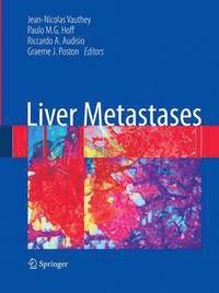 bokomslag Liver Metastases