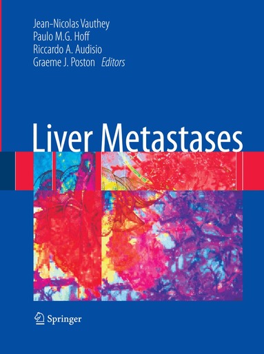 Jean-Nicolas` Vauthey, Paulo M. Hoff, Riccardo A. Audisio, Graeme J. Poston - Liver Metastases, Inbunden