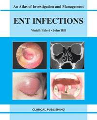 bokomslag ENT Infections