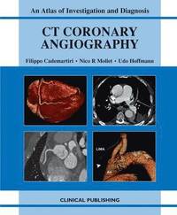 bokomslag CT Coronary Angiography: Atlas of Investigation and Management