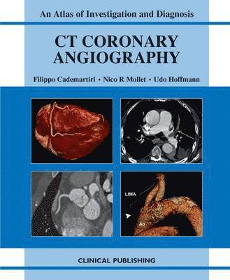 CT Coronary Angiography: Atlas of Investigation and Management 1