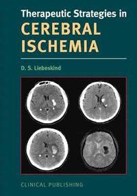 bokomslag Cerebral Ischemia