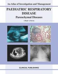 bokomslag Paediatric Respiratory Disease - Parenchymal Diseases
