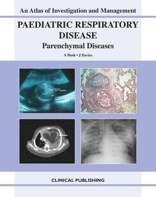Paediatric Respiratory Disease - Parenchymal Diseases 1