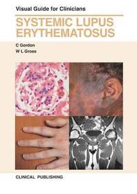 bokomslag Systemic Lupus Erythematosus