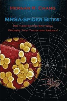 Hernan R. Chang, Hernan R. Chang, R. Chang, Hernan - MRSA - Spider Bites: The Flesh-Eating Bacterial Epidemic That Threatens America, Häftad