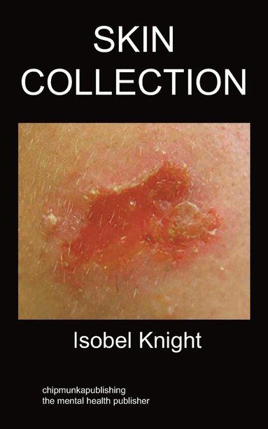 Isobel Knight - Skin Collection, Häftad