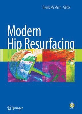 Modern Hip Resurfacing 1