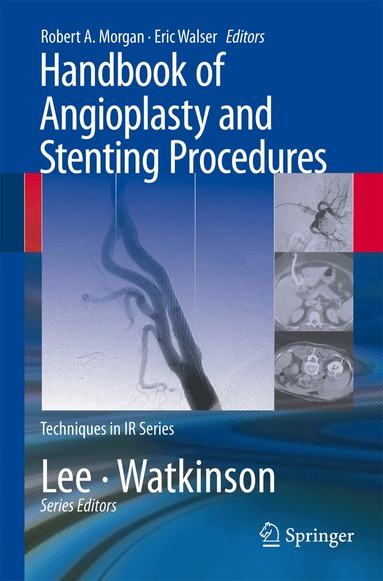 Robert A. Morgan, Eric Walser - Handbook of Angioplasty and Stenting Procedures, Häftad