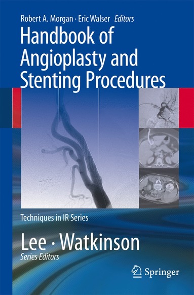 bokomslag Handbook of Angioplasty and Stenting Procedures