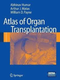 bokomslag Atlas of Organ Transplantation