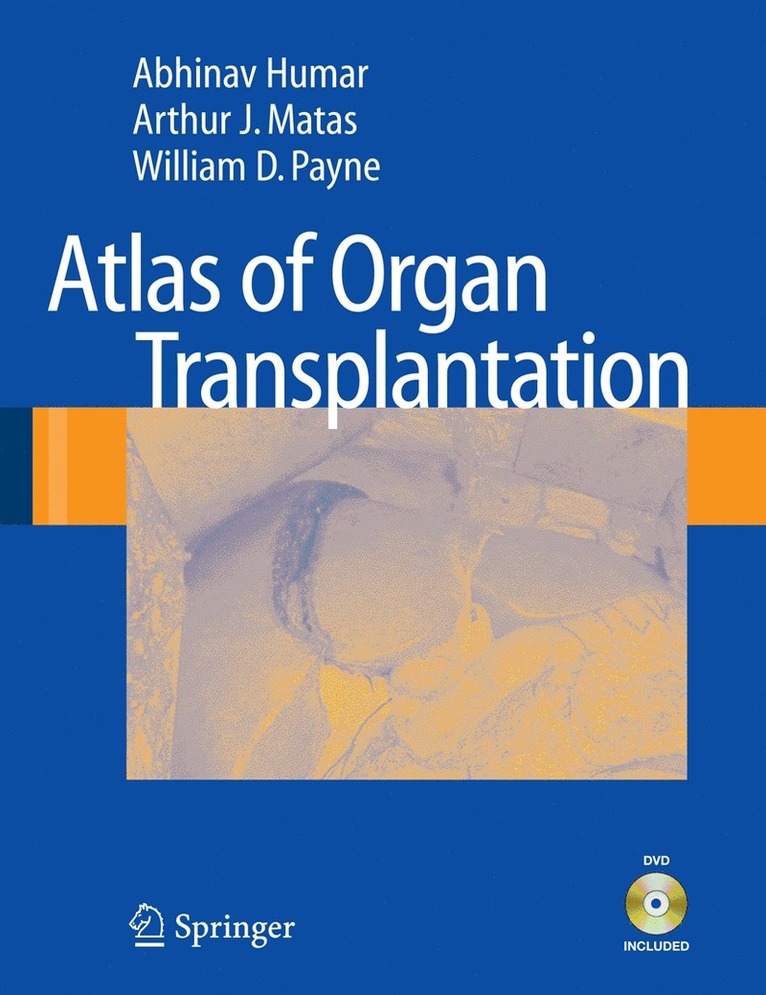 Abhinav Humar, Arthur J. Matas, William D. Payne - Atlas of Organ Transplantation, Häftad
