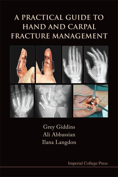 Grey Giddins, Ali Abbassian, Ilana Langdon - PRACTICAL GUIDE TO HAND AND CARPAL FRACTURE MANAGEMENT, A, Häftad