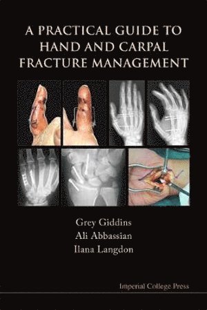 Grey Giddins, Ali Abbassian, Ilana Langdon, Uk) Giddins, Grey (The Hand To Elbow Clinic, Uk) Abbassian, Ali (The Hand To Elbow Clinic, Uk) Langdon, Ilana (The Hand To Elbow Clinic, GIDDINS GREY - Practical Guide To Hand And Carpal Fracture Management, A, Häftad