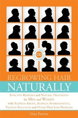 Regrowing Hair Naturally 1
