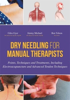 Dry Needling for Manual Therapists 1