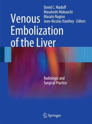 Venous Embolization of the Liver 1